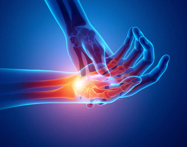 久留米市で手首や肘の痛み、腱鞘炎の症状にお困りの方は一度いしばし整骨院へ！